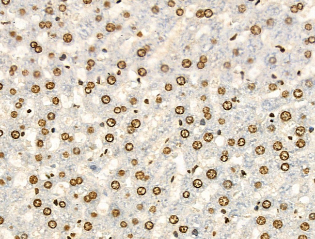 H4K91ac Antibody in Immunohistochemistry (Paraffin) (IHC (P))