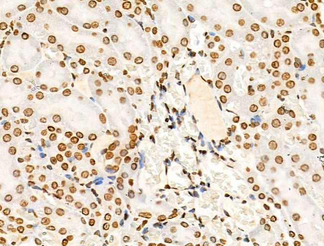 H4K91ac Antibody in Immunohistochemistry (Paraffin) (IHC (P))