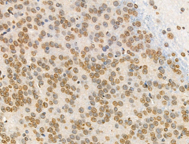 H4K91ac Antibody in Immunohistochemistry (Paraffin) (IHC (P))