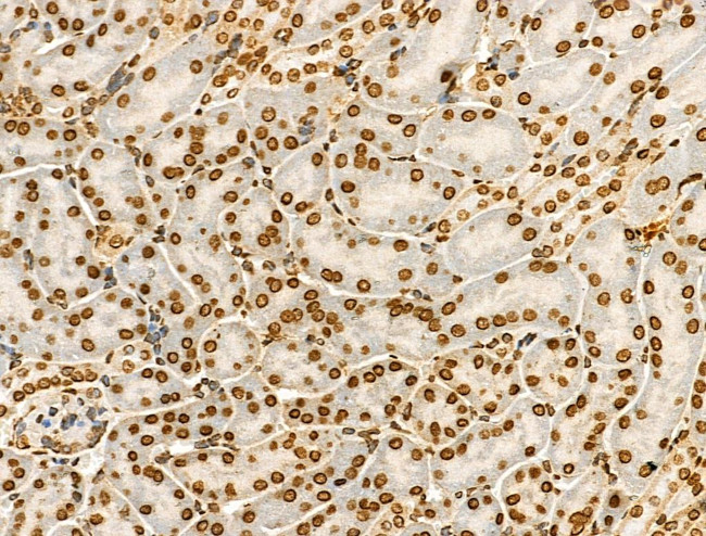 H4K91ac Antibody in Immunohistochemistry (Paraffin) (IHC (P))