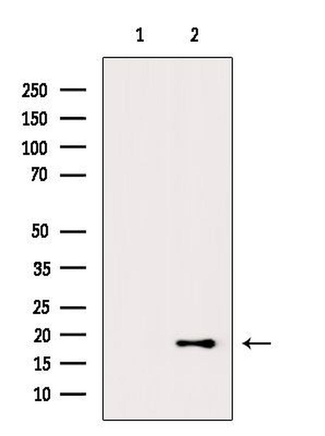 H3K122ac Antibody in Western Blot (WB)