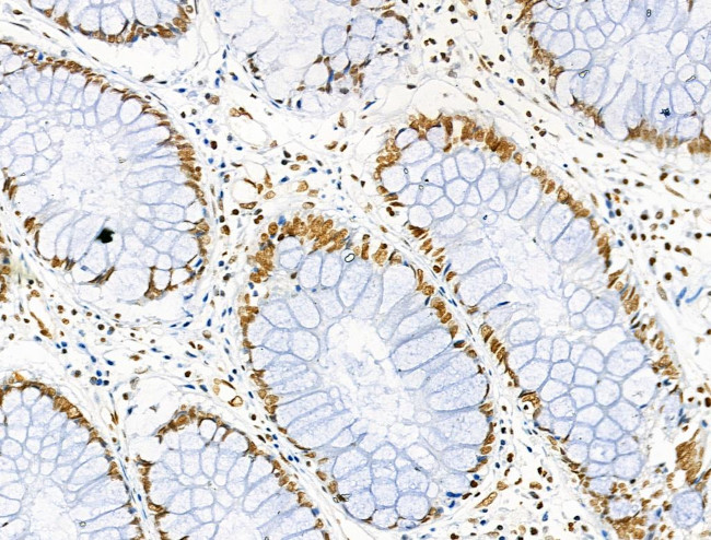 H3K122ac Antibody in Immunohistochemistry (Paraffin) (IHC (P))