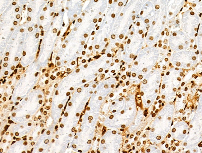 H3K122ac Antibody in Immunohistochemistry (Paraffin) (IHC (P))