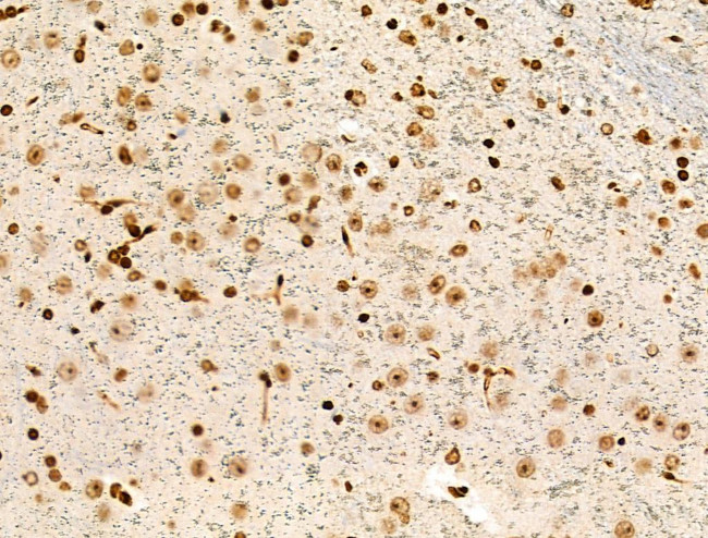 H3K122ac Antibody in Immunohistochemistry (Paraffin) (IHC (P))