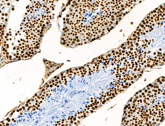 H3K122ac Antibody in Immunohistochemistry (Paraffin) (IHC (P))