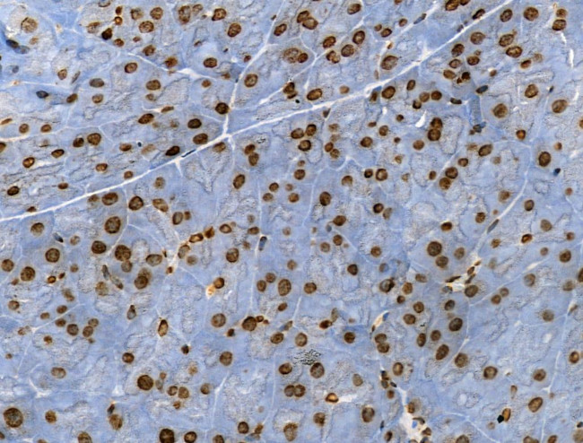 H3K122ac Antibody in Immunohistochemistry (Paraffin) (IHC (P))