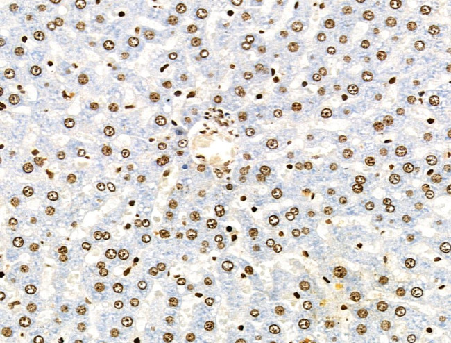 H3K122ac Antibody in Immunohistochemistry (Paraffin) (IHC (P))