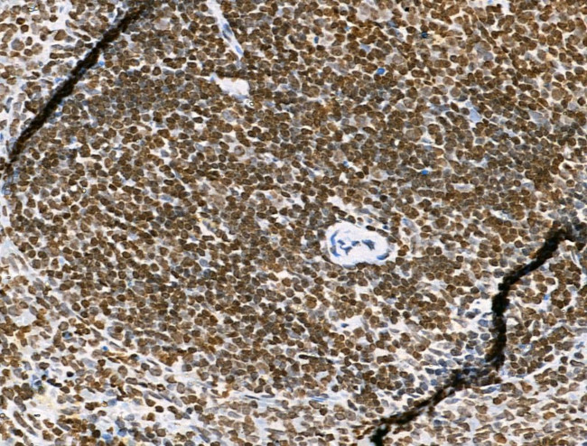 H3K122ac Antibody in Immunohistochemistry (Paraffin) (IHC (P))