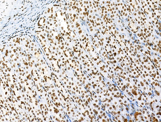 H3K122ac Antibody in Immunohistochemistry (Paraffin) (IHC (P))