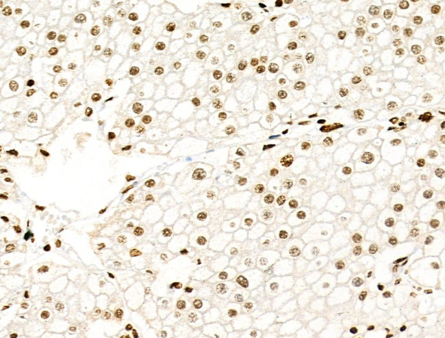 H3K122ac Antibody in Immunohistochemistry (Paraffin) (IHC (P))