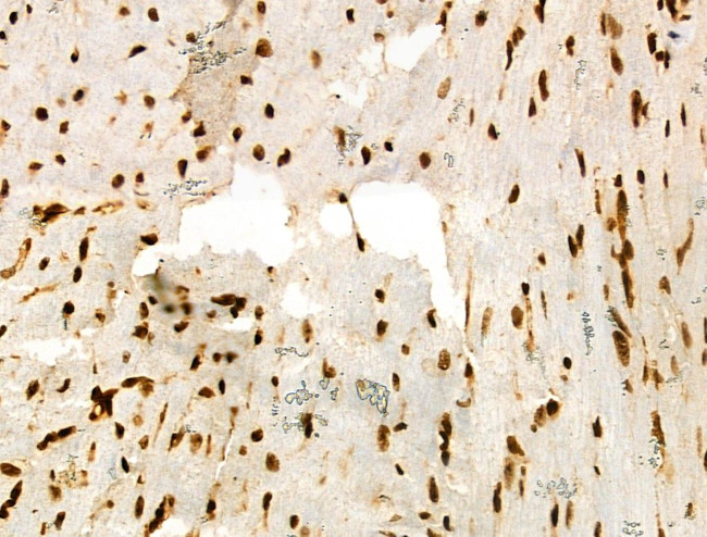 H3K122ac Antibody in Immunohistochemistry (Paraffin) (IHC (P))