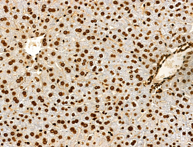 H3K122ac Antibody in Immunohistochemistry (Paraffin) (IHC (P))