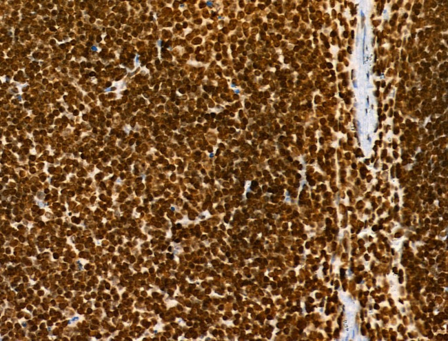 H3K122ac Antibody in Immunohistochemistry (Paraffin) (IHC (P))