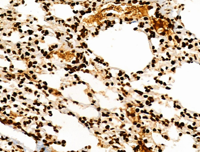 H3K122ac Antibody in Immunohistochemistry (Paraffin) (IHC (P))