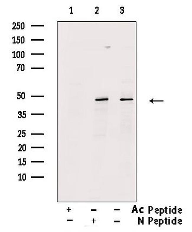 Acetyl-p53 (Lys373) Antibody in Western Blot (WB)