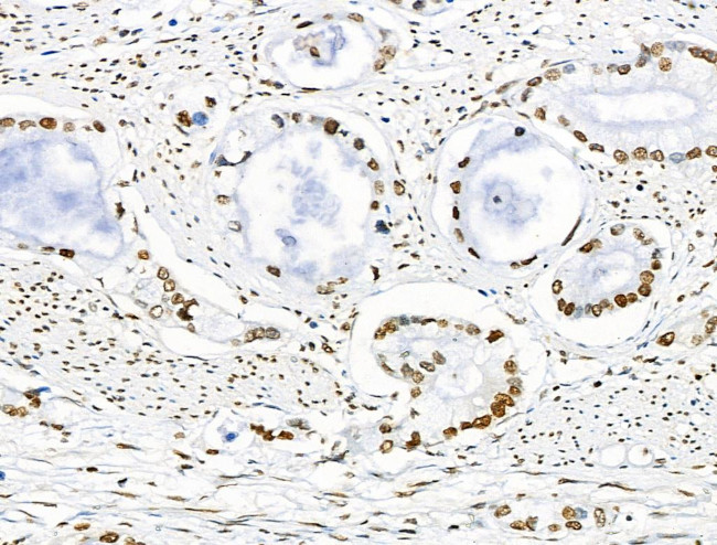 Acetyl-p53 (Lys373) Antibody in Immunohistochemistry (Paraffin) (IHC (P))