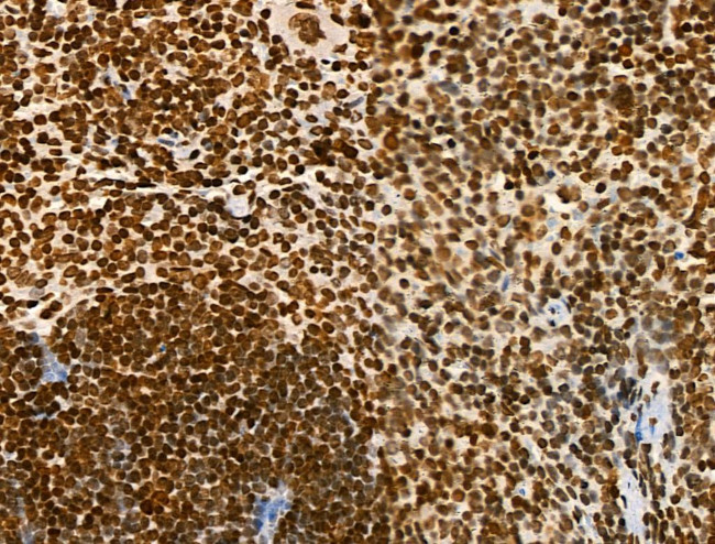 Acetyl-p53 (Lys373) Antibody in Immunohistochemistry (Paraffin) (IHC (P))