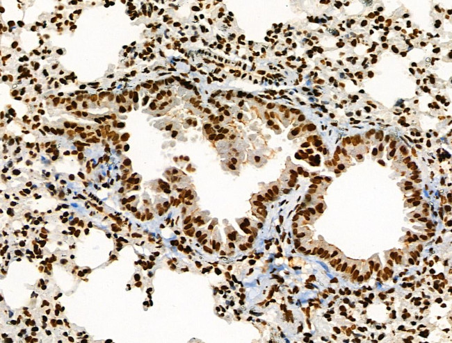 Acetyl-p53 (Lys373) Antibody in Immunohistochemistry (Paraffin) (IHC (P))