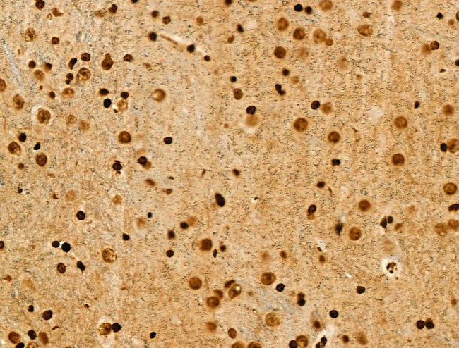 Acetyl-p53 (Lys373) Antibody in Immunohistochemistry (Paraffin) (IHC (P))