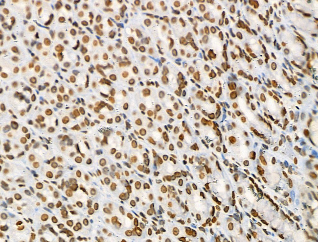 Acetyl-p53 (Lys373) Antibody in Immunohistochemistry (Paraffin) (IHC (P))