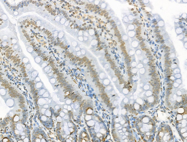 Acetyl-p53 (Lys373) Antibody in Immunohistochemistry (Paraffin) (IHC (P))