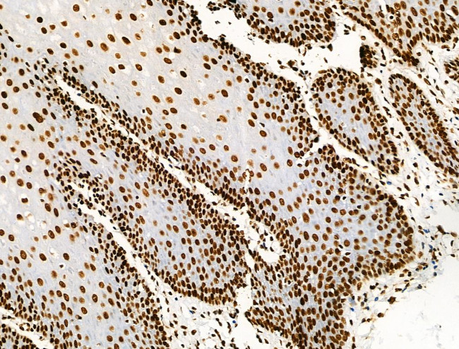 Acetyl-p53 (Lys373) Antibody in Immunohistochemistry (Paraffin) (IHC (P))