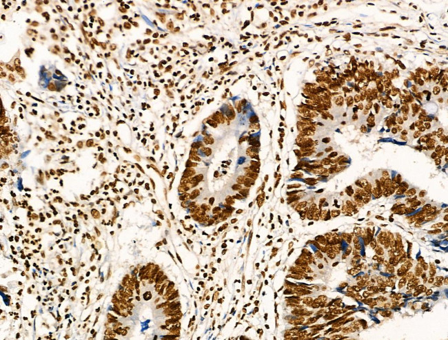 Acetyl-p53 (Lys373) Antibody in Immunohistochemistry (Paraffin) (IHC (P))