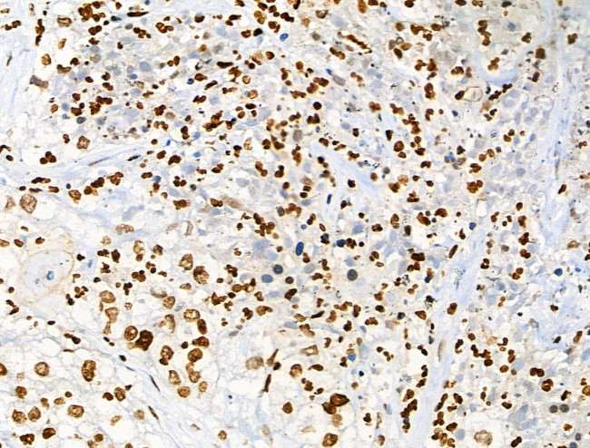 Acetyl-p53 (Lys373) Antibody in Immunohistochemistry (Paraffin) (IHC (P))