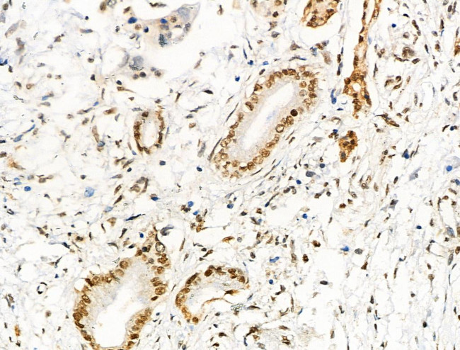 Acetyl-p53 (Lys373) Antibody in Immunohistochemistry (Paraffin) (IHC (P))