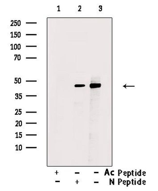 Acetyl-p53 (Lys381) Antibody in Western Blot (WB)