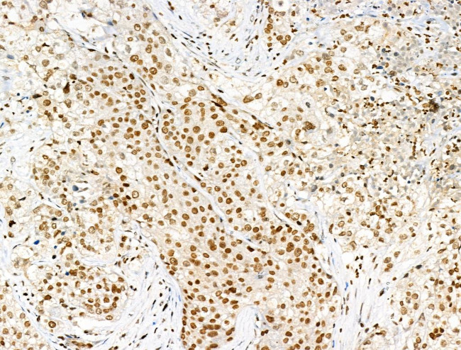 Acetyl-p53 (Lys381) Antibody in Immunohistochemistry (Paraffin) (IHC (P))