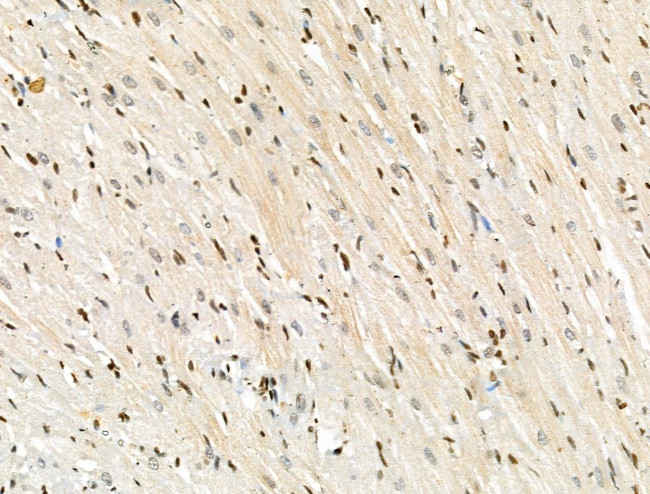 Acetyl-p53 (Lys381) Antibody in Immunohistochemistry (Paraffin) (IHC (P))