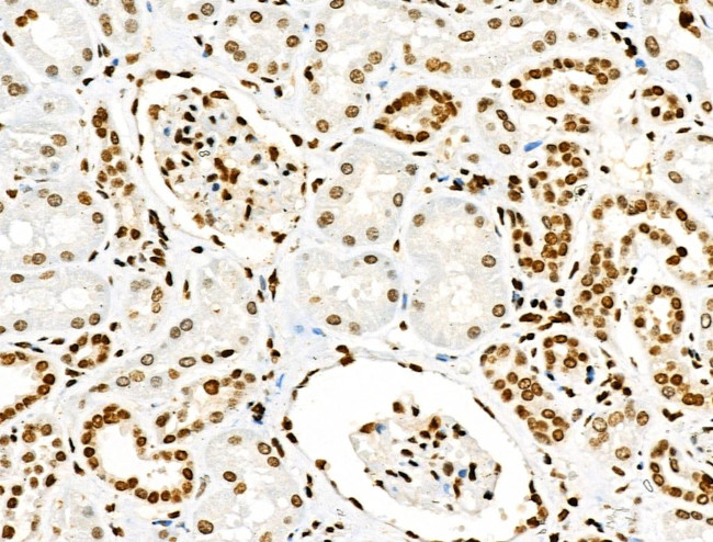 Acetyl-p53 (Lys381) Antibody in Immunohistochemistry (Paraffin) (IHC (P))