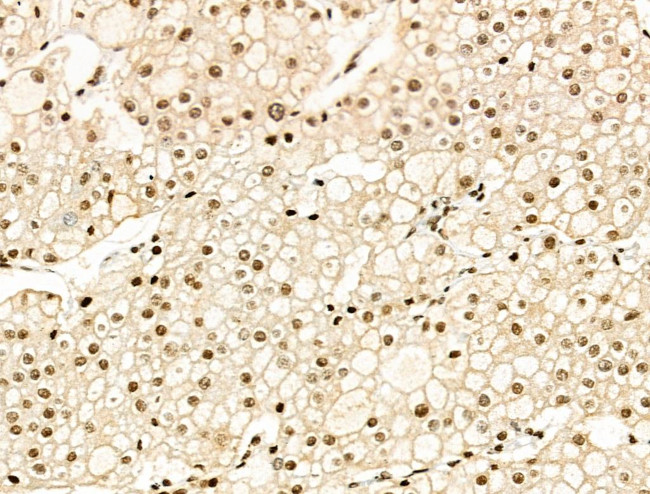 Acetyl-p53 (Lys381) Antibody in Immunohistochemistry (Paraffin) (IHC (P))