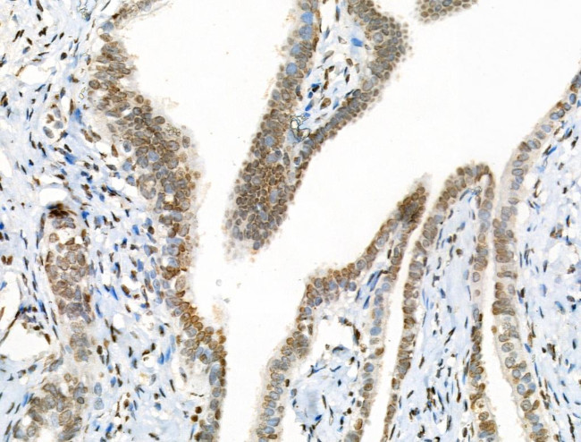 Acetyl-p53 (Lys381) Antibody in Immunohistochemistry (Paraffin) (IHC (P))