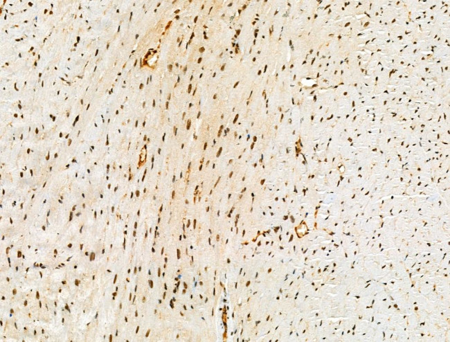 Acetyl-p53 (Lys381) Antibody in Immunohistochemistry (Paraffin) (IHC (P))