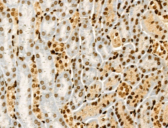 Acetyl-p53 (Lys381) Antibody in Immunohistochemistry (Paraffin) (IHC (P))