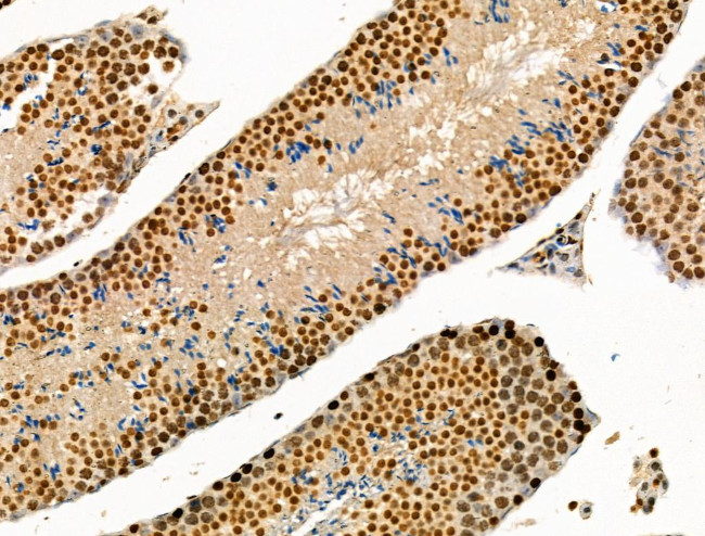 Acetyl-p53 (Lys381) Antibody in Immunohistochemistry (Paraffin) (IHC (P))