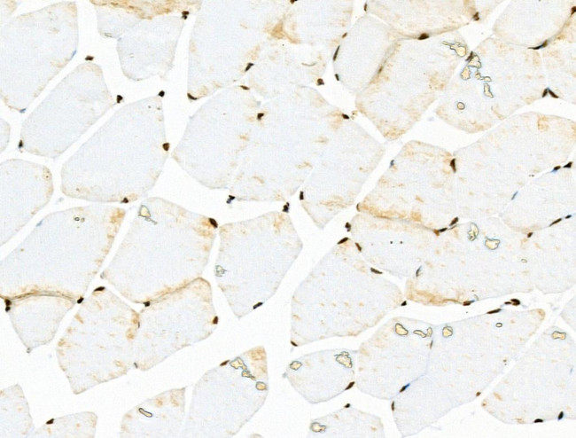 Acetyl-p53 (Lys381) Antibody in Immunohistochemistry (Paraffin) (IHC (P))