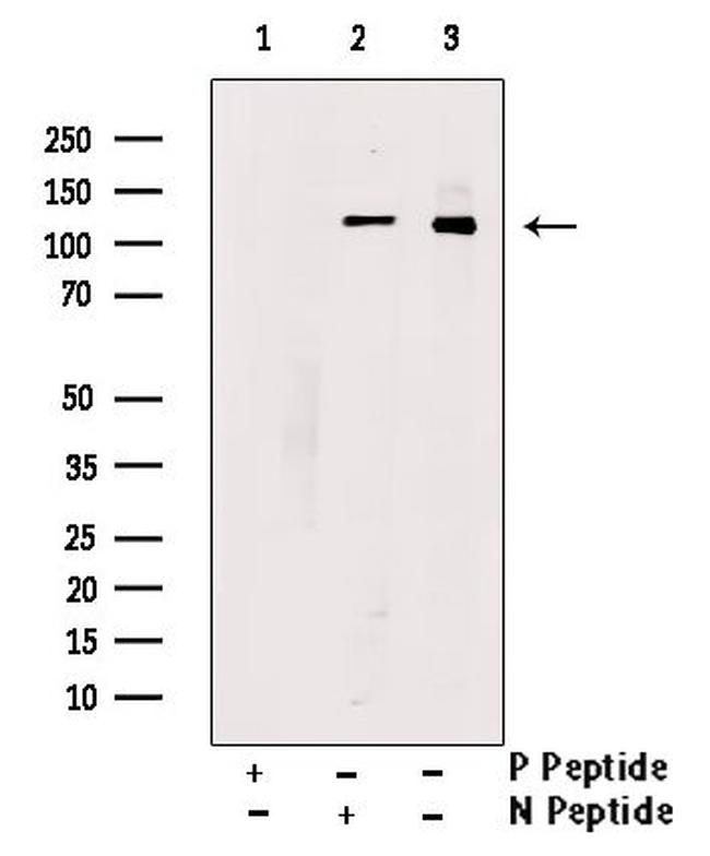 Phospho-PIK3CA (Ser317) Antibody in Western Blot (WB)