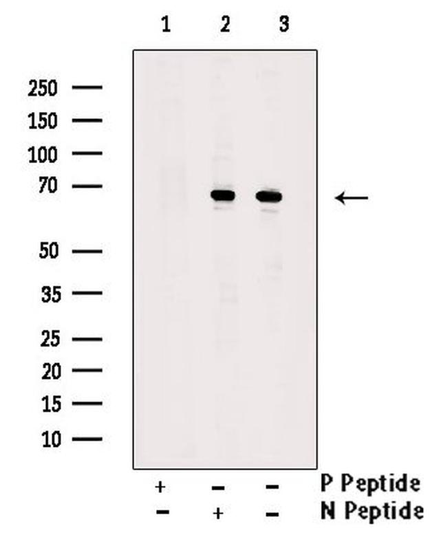 Phospho-IRAK-M (Ser510) Antibody in Western Blot (WB)