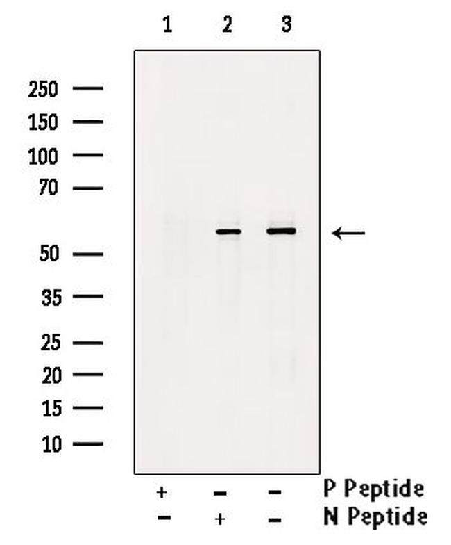 Phospho-IRAK4 (Thr342) Antibody in Western Blot (WB)