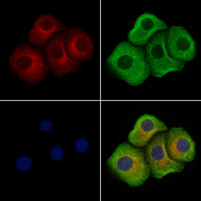 Phospho-LAT (Tyr220) Antibody in Immunocytochemistry (ICC/IF)