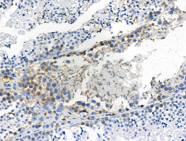 Phospho-LAT (Tyr220) Antibody in Immunohistochemistry (Paraffin) (IHC (P))