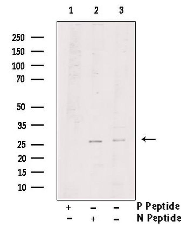 Phospho-LAT (Tyr220) Antibody in Western Blot (WB)