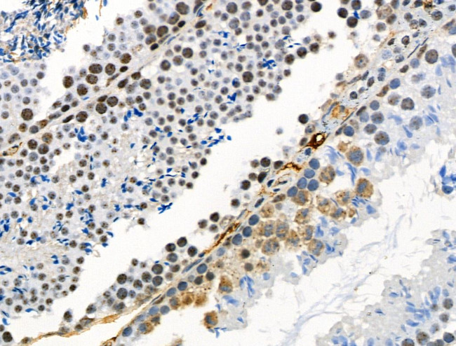 Phospho-delta Catenin (Ser320) Antibody in Immunohistochemistry (Paraffin) (IHC (P))