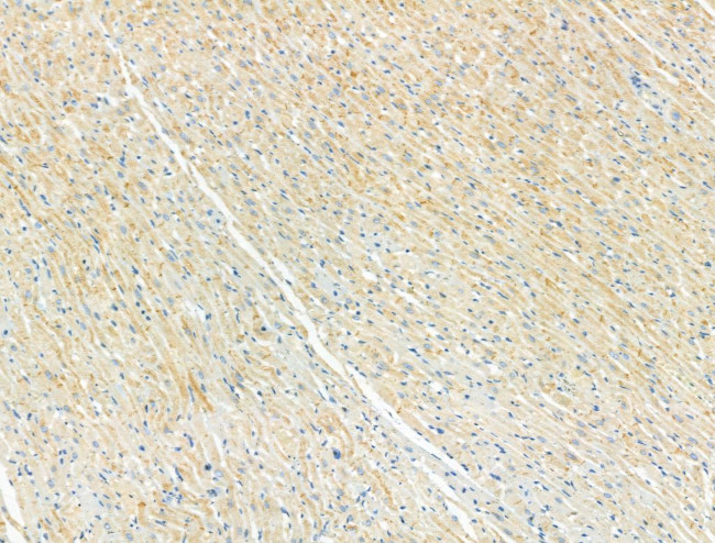 Phospho-ULK1 (Ser758) Antibody in Immunohistochemistry (Paraffin) (IHC (P))