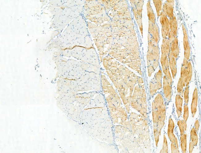 Phospho-ULK1 (Ser758) Antibody in Immunohistochemistry (Paraffin) (IHC (P))