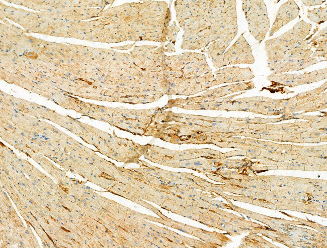 Phospho-ULK1 (Ser758) Antibody in Immunohistochemistry (Paraffin) (IHC (P))