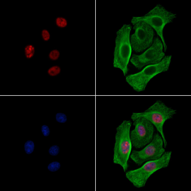 Phospho-ALOX5 (Ser272) Antibody in Immunocytochemistry (ICC/IF)